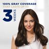 Nice & Easy Rt Tch #5g Size 1kit