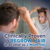 Extra Strength Minoxidil 5% for Men - 12 Oz Unscented Hair Regrowth Solution