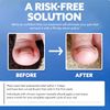 CurveCorrect Ingrown Toenail Home Treatment