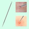Titanium Lancet Needle Acne Blackhead Remover Pimple Extractor Popper Tool