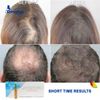 Restructuring Solution for Hair Growth Serum Mesotherapy De Nova