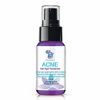 Diva Stuff Acne Gel Spot Treatment, Extra Strength Formula, AHA, 1oz, Diva Stuff