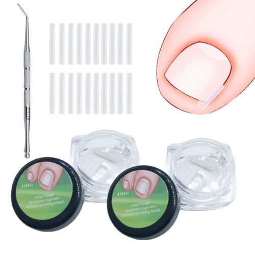101 Pcs Ingrown Toenail Treatment Set, Clear Ingrown Toenail Corrector with Nail Picker, Plastics Correction Strips Brace Kit, Straightener Strips for Women Men Foot Care