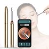 ear wax remover camera iphone