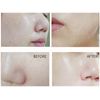 Anjo  Professional Skin Soft Snail Peeling Gel