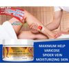 SET varicose Veins Phlebitis support relief varices stem cell cream spider