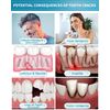 Healing Teeth Crack Toothpaste - Repairing Cracked Teeth Enamel, Remineralizing Toothpaste 100g