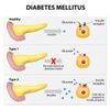TRIGLYCERIDES HIGH & BAD CHOLESTEROL REMOVER & FLUSHER  & SUGAR  DOWN