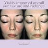 Exuviance Overnight Transformation Complex