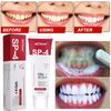 120g SIP-4 Probiotic Toothpaste, Whitening Sp-4 Probiotic Toothpaste Whitening