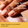 ACURE - Everyday Eczema Unscented Lotion - 8 fl oz (236.5 ml)
