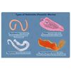 (Intestinal Worms) (ANTI PARASITES) DESTROY EGGS - KILL &  FLUSH THEM OUT - USA