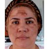 Tabella Skincare Goodbye Dark Spots Hello Brighter Skin, Fast & Effective, 5oz.