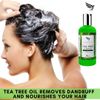 Tea Tree Oil Anti Dandruff Shampoo - [Made In UK] Therapeutic Grade | Antifungal for Dry Itchy Flaky Scalp and Hair | Prevents Head Lice Men Women | 250ml