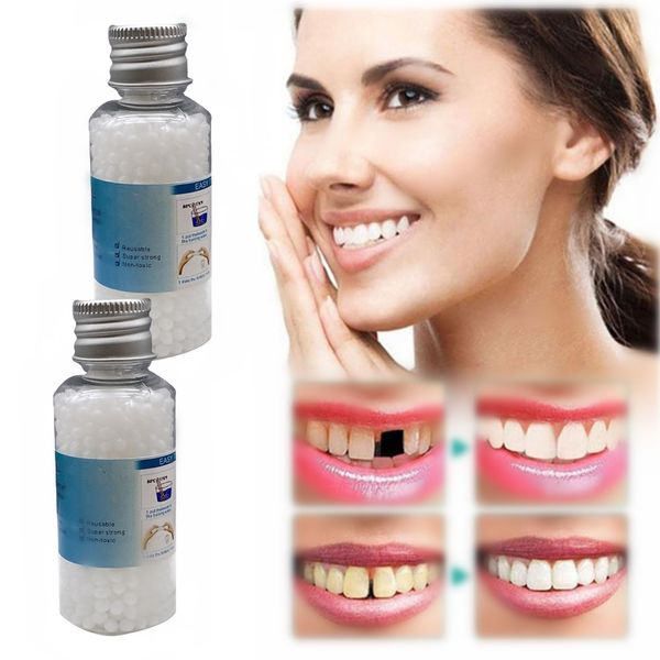 Fitting Beads Dental Resin Plastic Heat Beads Gum Adhesive Fake Teeth Upper Lower Teeth Veneer Denture Care Supplies Temporary Tooth Repair Kit Chipped First Aid Repair Missing Teeth Clean Top and