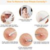 Blemish Blackhead Remover 5 Piece Set Extractor Tools Pimple Removal Kit White