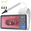 3.9mm Otoscope Camera 1920x1080 Smart Visual Ear Wax Removal 4.5" IPS Screen