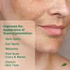 Dark Spot Treatment