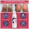 FOOTLOGIX Rough Skin Formula with Spiraleen, 4.23 oz
