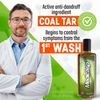 Shampoo Anticaspa Champu Para La Caspa Psoriasis Tratamiento Cabello Dermatitis