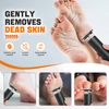Callus Remover for Feet