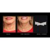 NeckTITE Magic Instant Neck Lift, 12 Count - Smooths Wrinkles for Adults
