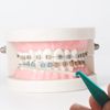 20 Pack Dental Elastic Rubber Bands Placers for Braces, Multi-color Braces Rubber Band Tool Disposable Plastic Orthodontic Elastic Placers