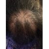 Hair  Miracle Growth oil