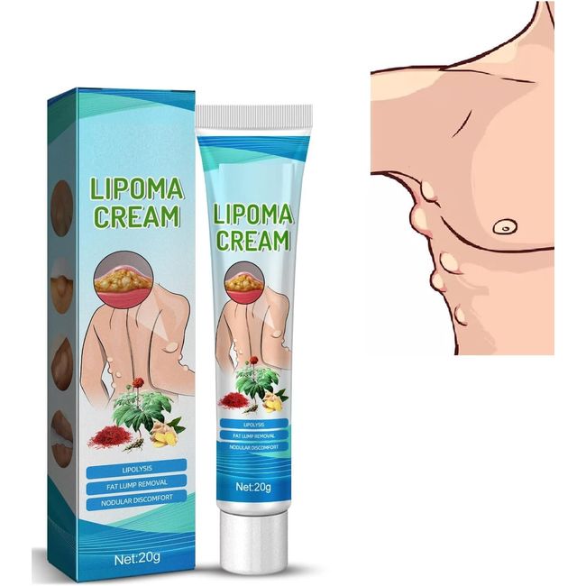 Cellulite Entfernung Peeling Creme,Lipom Entfernung Creme,Lipom Klumpen Creme,Lipomsalbe,Cremesalbe zur Entfernung von Lipomen, NatüRliche Pflanzliche Creme zur Entfernung von Lipomklumpen 20g