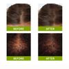 PREMICES HAIR GROWTH TREATMENT