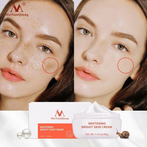 Powerful Whitening Freckle Cream & Dark Spot Remove Skin Care Beauty Essentials