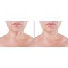 Crepe Be Gone Skin Firming Neck Mask