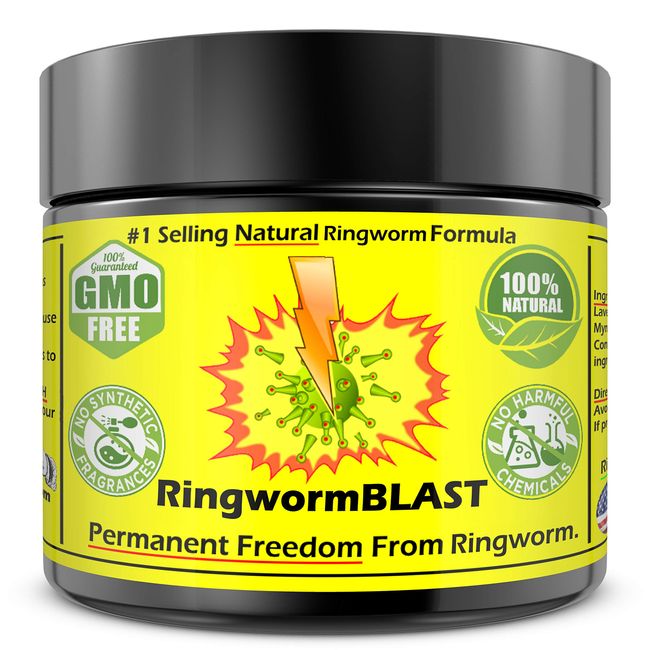 Ringworm Relief Fast Cream Ointment Dermatologist & Lab Tested Better Than Shampoo Adults and Kids Natural Extra Strength No Paraben No Chemicals Hypoallergenic