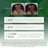 Triphasic Progressive Tratamiento Anti-Caida 8 X 5,5 Ml