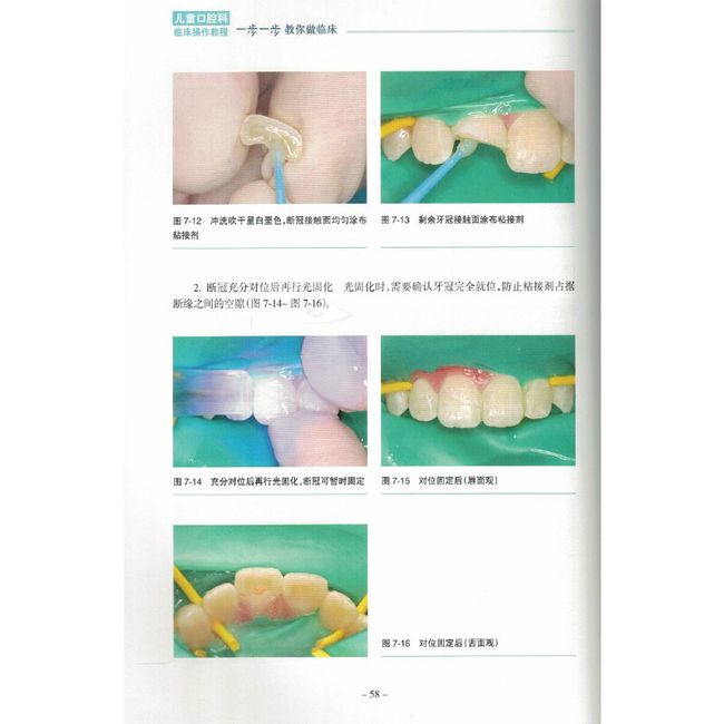 儿童口腔科临床操作教程一步一步教你做临床彩图版 儿童口腔临床医学工具书籍秦满 9787117244497人民卫生出版社儿科保健口腔牙科