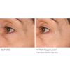 NassifMD Wrinkle Blur Targeted Treatment