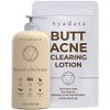 Ayadara Butt Acne Clearing Lotion | Pimple & Zit Prevention Booty Cream with Salicylic Acid & Tea Tree | Moisturizing Cystic Acne Treatment for Buttocks | Women, Men, Teens, & Adults | 90-Day Supply