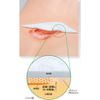silicone gel dressing for wounds 3