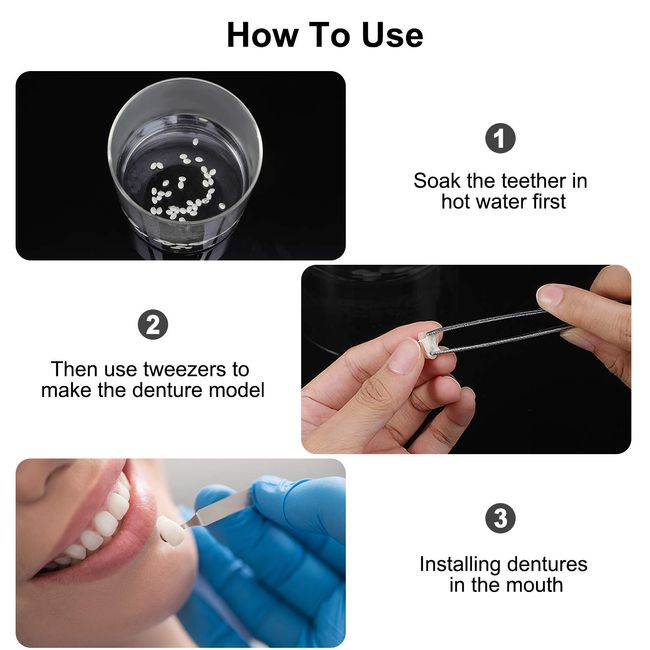 Teeth Repair Kit 100G Teeth Replacement Kit Moldable False Teeth Thermal  Fitting Beads Filling The Missing Broken Tooth Safe - AliExpress