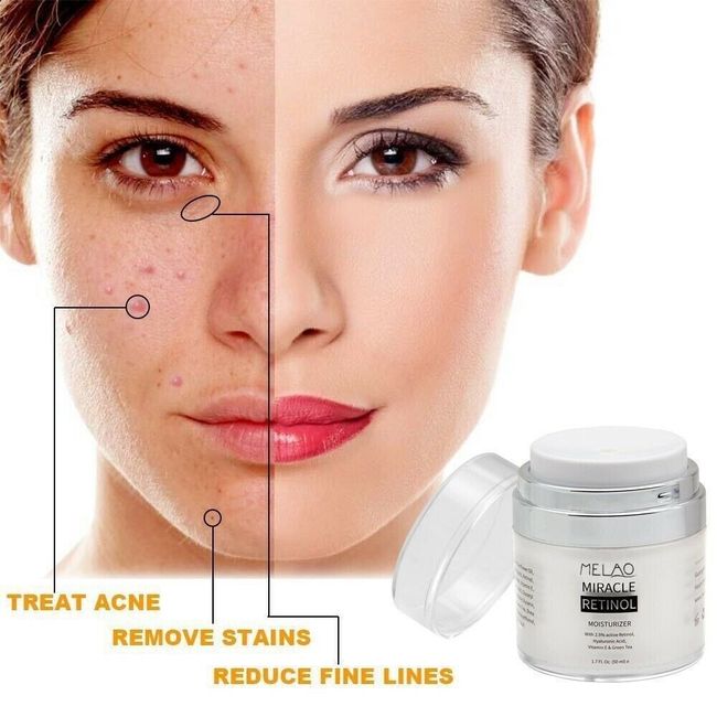 Anti-Aging Wrinkles Firming Pigmentation Dark Spot Hyaluronic Acid Retinol Cream