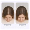 GROWPLEX Complex10 Hair Support Supplement with Biotin Collagen & 10 Essentia...