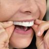 SleepRight Gen 2 Pro-RX Dental Guard (New Version)