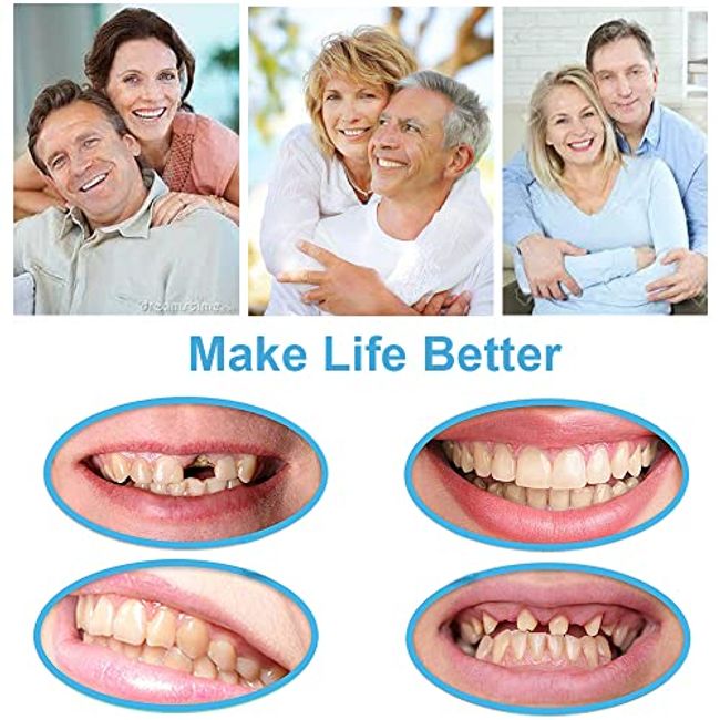 Tooth Repair Kit, Moldable False Teeth,DIY Dental Repair Kit Glue for  Broken,Missing, Gaps, Regain