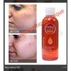 X 1 Bottle Recovery Oil. Osiris Hydrates, Help Against Scars & Stretch Marks👌👌