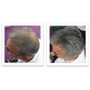 Caboki Hair Loss Concealer, 90-day supply, Dark Gray