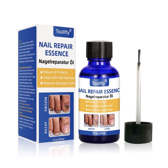 Nagelpflege und Behandlung, NägelReparatur,Nagelpflege für gesunde Fuß und Hand, Nagelöl, Nagelpflegeöl, Nagelpflege pflegend, Nail Essence Serum, Fur Gebrochene und Verfärbte Nägel