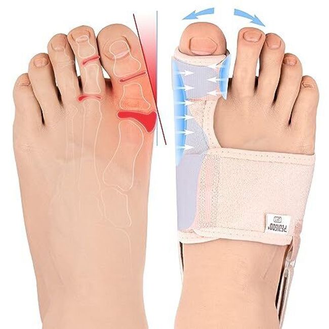 Bunion Corrector for Women 2pc Non-Slip Bunion Toe Separator Hallux Valgus Re...