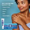 Scar Zone Advanced Scar Removal Cream - Scar Cream for Surgical Scars, Stretch Marks Removal, C Section & Fades Old & New Scars (0.75 oz, Pack of 3)