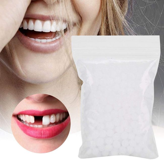 Temporary Tooth Replacement, Instant Veneers Dentures, Denture Teeth, Temporary Tooth Repair Multifunction Temporary Tooth Repair Set For Missing Tooth Filling Material With Broken Teeth(50g)