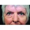 RX Flawless Eyes - 1 x 10ml Bottle. 100 Applications
